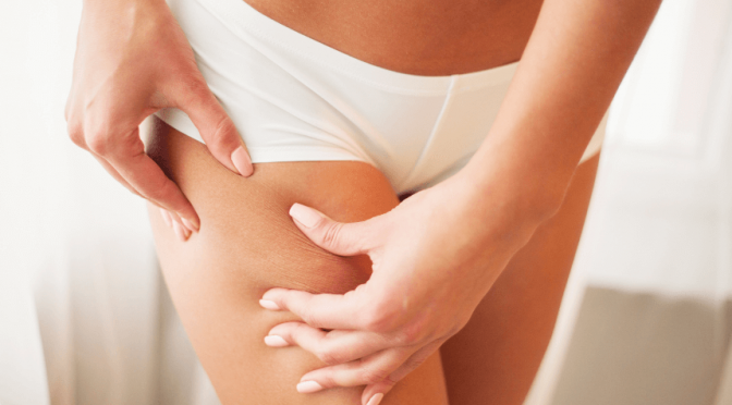 To prevent cellulite, there are some habits you should incorporate into your daily routine